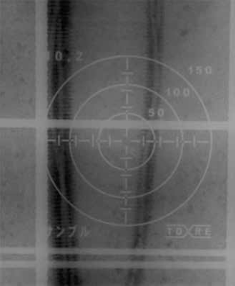 X線レントゲン画像 埋設CD管透過フィルム